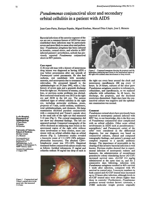 Pseudomonas Conjunctival Ulcer And Secondary Orbital Cellulitis In A