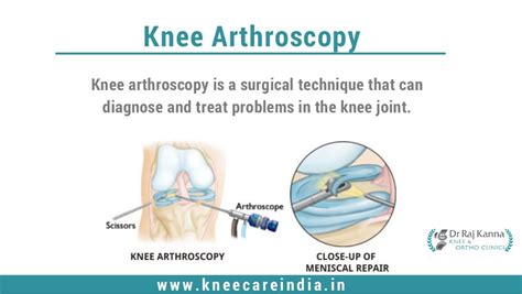 Keyhole Surgery in Chennai | Keyhole Surgery in India