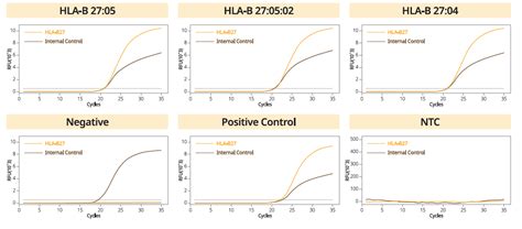 Gcdia™ Hla B27 Real Time Pcr Kit Genes Laboratories