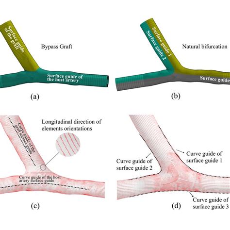 Surface Guides Needed To Define The Element Orientations Of The Bypass Download Scientific