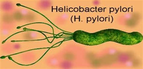 H pylori bacteria infection symptoms, diagnosis and treatment