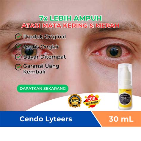 Jual Obat Mata Kering Perih Dan Gatal Kotor Belekan Cendo Lyteers