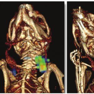 Molecular Imaging Of Fibrin In Jugular Vein Thrombus By Integrated