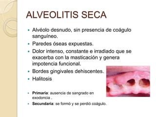 Alveolitis PPT