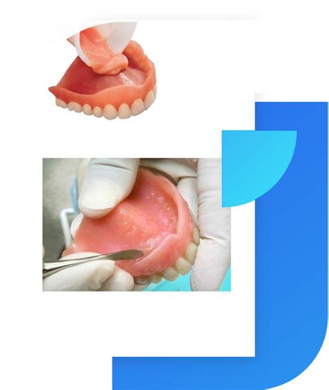 Relines And Rebase Shore Side Denture Clinic