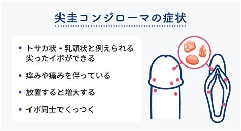コンジローマの検査方法とは？症状を知って正しく治療しよう - ルナレディースクリニックのメディア
