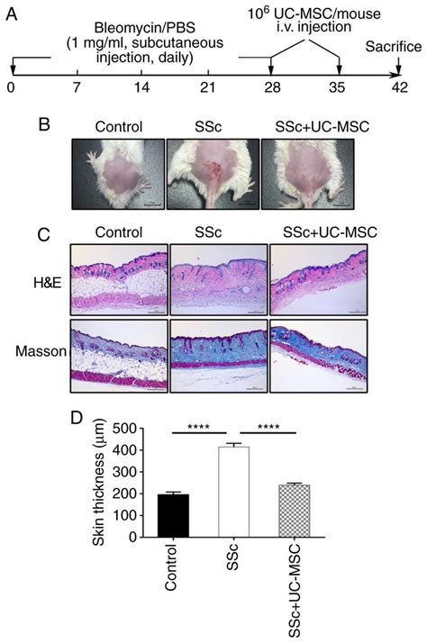 Uc Msc Treatment Ameliorates Bleomycin Induced Skin Fibrosis A The