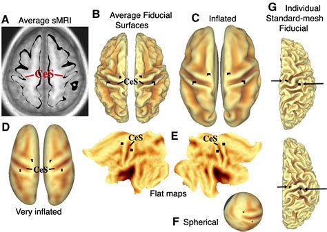 Surface Based And Probabilistic Atlases Of Primate Cerebral Cortex Neuron