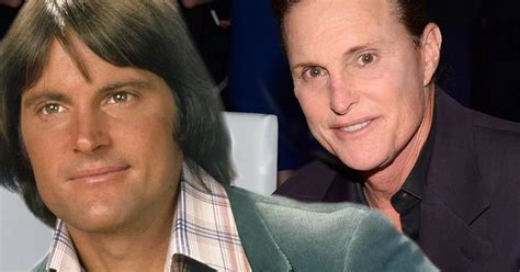 Bruce Jenner Could Spend Up To 250 000 On Sex Change If He Has FULL