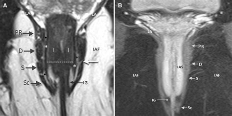 A T2 Weighted And B Contrast Enhanced Fat Suppressed T1 Weighted Tse