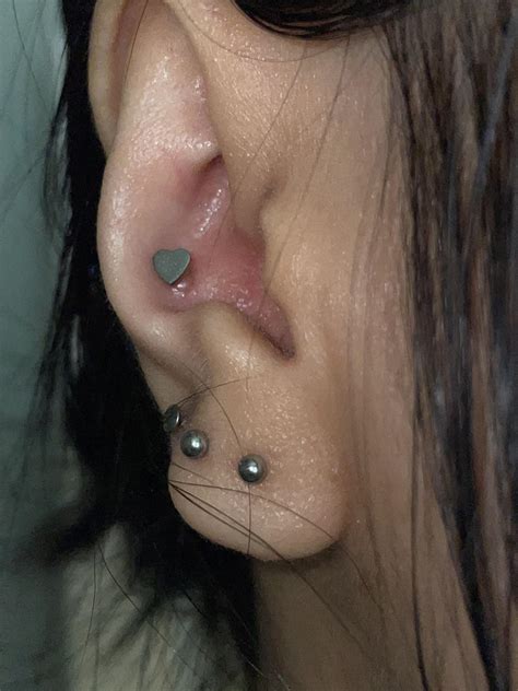 Is That An Irritation Bump At My Conch Piercing R Legitpiercing