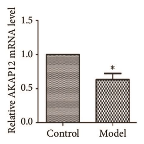 Real Time Rt Pcr Analysis For 15 Top Degs ∗p Download Scientific Diagram