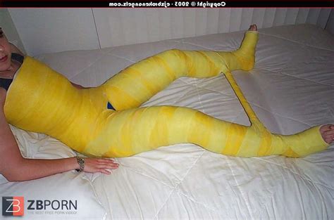 Gips Cast ZB Porn