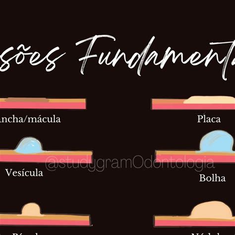 Lesões Fundamentais estomatologia lesão fundamental boca odonto