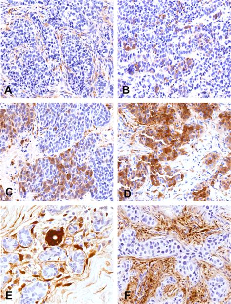 Representative Immunohistochemical Staining Intensity Of Aldh1 For