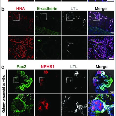 Expression of renal epithelial and progenitor cell markers in... | Download Scientific Diagram