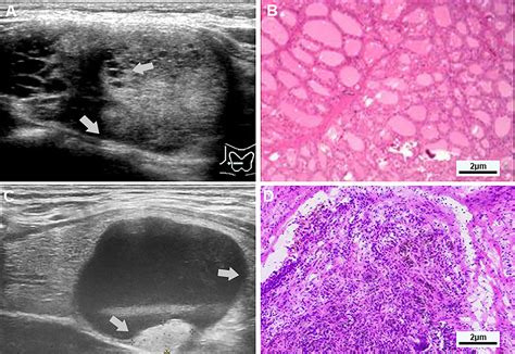 Frontiers Analysis Of Differential Diagnosis Of Benign And Malignant