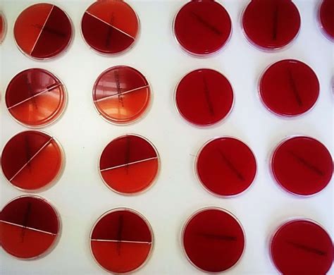 Microbiology | Cytopath