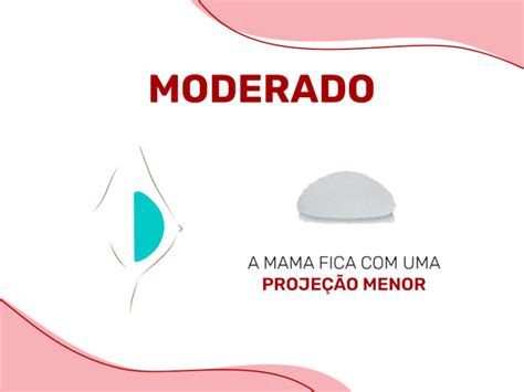 Tipos De Pr Tese De Silicone Tudo Que Voc Precisa Saber