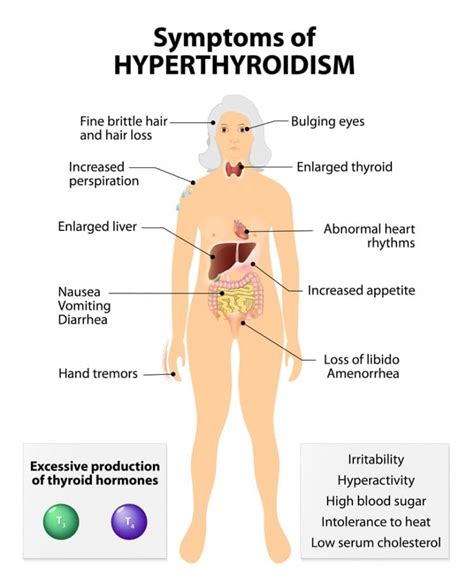 Thyroid Dysfunction Presentation