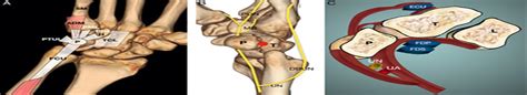 Techniques In Hand And Upper Extremity Surgery