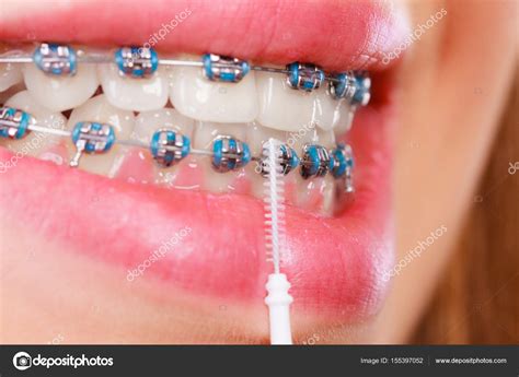 Mujer cepillándose los dientes con aparatos ortopédicos usando cepillo