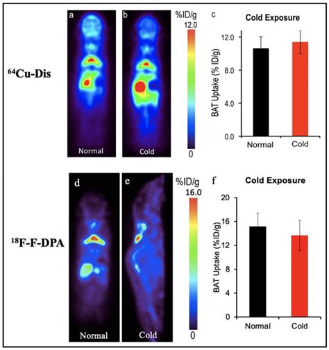 Ijms Free Full Text Molecular Imaging Of Brown Adipose Tissue Mass