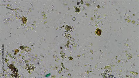 naked amoeba in compost and soil under the microscope vídeo do Stock