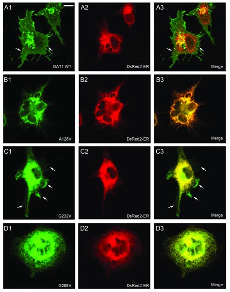 Subcellular Distribution Of Gat 1 Variants In Transfected Cells Cos7