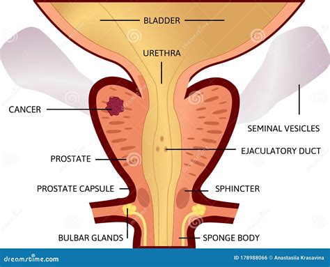 Prostate Cancer Anatomy Stock Illustrations – 1,334 Prostate Cancer ...