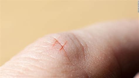 Why Do Papercuts Hurt So Much? – Food for Skin