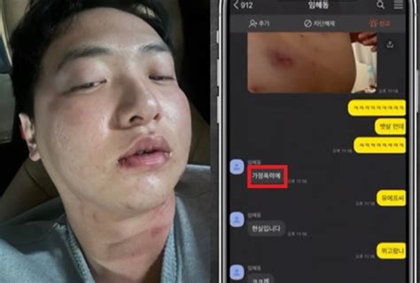 김하성이 폭행 Vs 임혜동 가정폭력···증거 사진 두고 선후배 진실 공방 네이트 뉴스