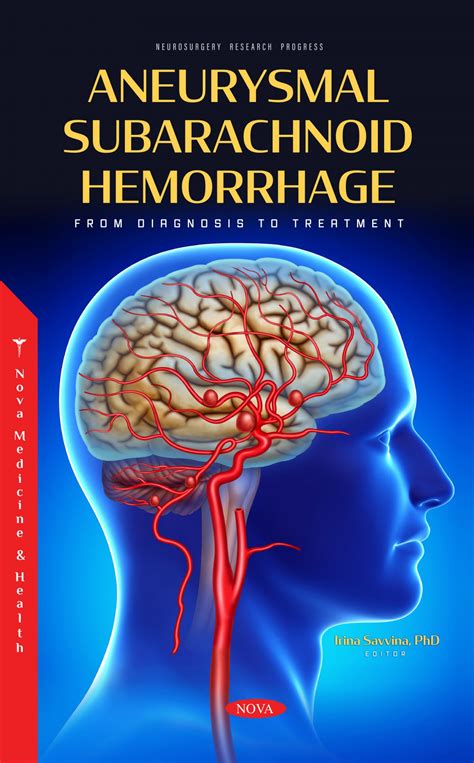 Aneurysmal Subarachnoid Hemorrhage: From Diagnosis to Treatment – Nova
