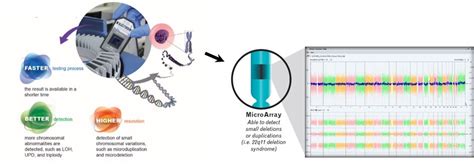 SNP microarray for amniocentesis - GGA Malaysia