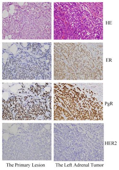 Reports Free Full Text A Case Of 10 Year Survival After