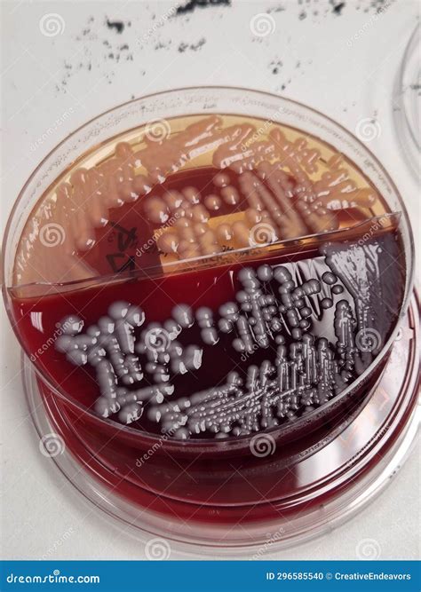 Klebsiella Pneumoniae Bacteria Growing On Blood And Macconkey Agar