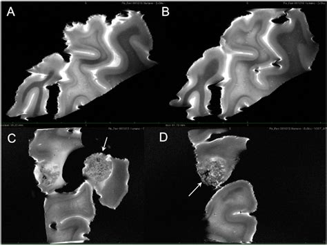 A B C And D Show Different Slices Of Ex Vivo Mri Acquired From Human