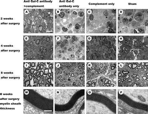 The Representative Tem Images Of Regenerated Axons And Myelin Sheath