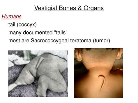 Ppt Vestigial Bones And Organs Vestige Powerpoint Presentation Id4502724