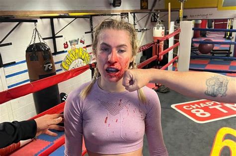 Onlyfans Boxer Astrid Wett Left Bloody Mess After Brutal Spar Ahead