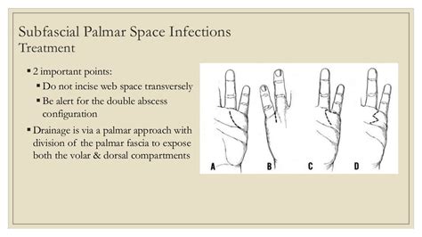 Hand infections