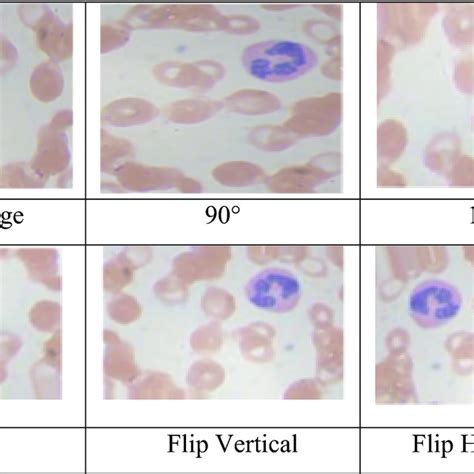 Microscopic images of WBC. | Download Scientific Diagram