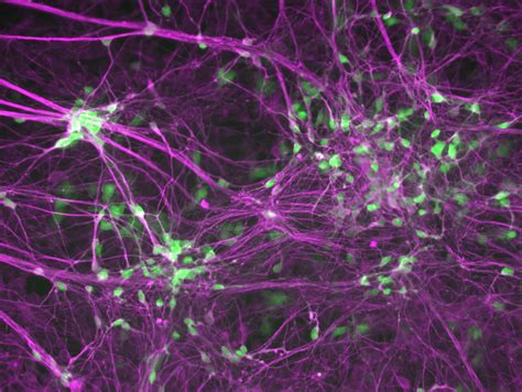 Motor Neuron Microscope