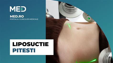 Liposuctie Pitesti Top Clinici Prețuri Programare Online