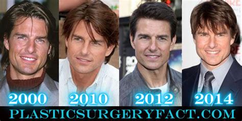 Tom Cruise Nose Job Before and After