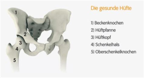 Tell Klinik H Ftprothesen Totalendoprothese Konventionelle Und