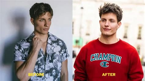 Matt Rife Plastic Surgery & Weight Loss. Glow Up And Before After Pictures.