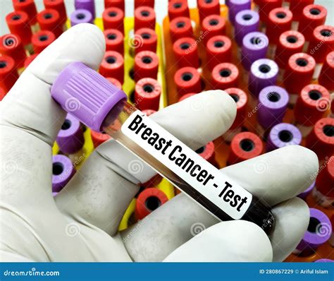 Blood Sample For Breast Cancer Test Stock Image Image Of Cells