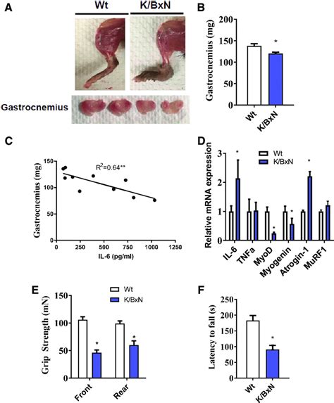 Muscle Atrophy In The K Bxn Mouse Model A Representative Images Of