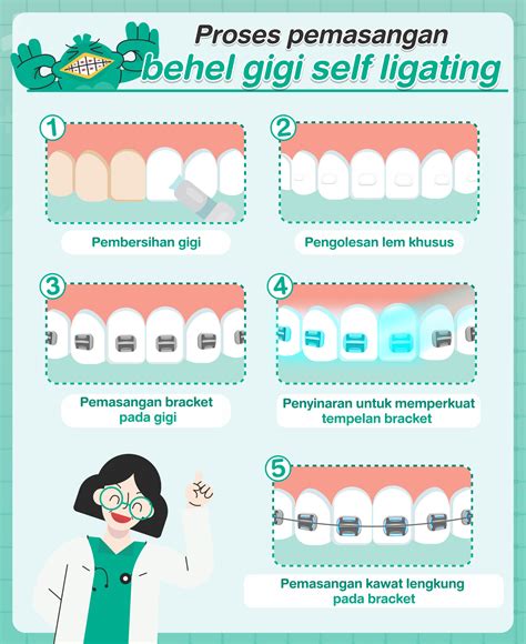 Pasang Behel Self Ligating Crystal Clear Oleh Drg Spesialis Ortodontik